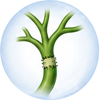 Hepatico-jejunostomy