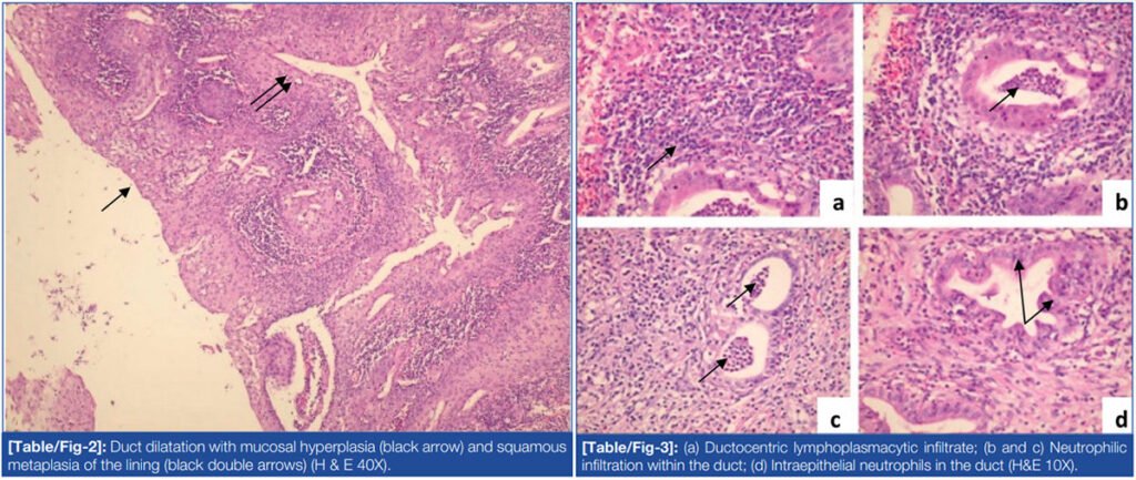 The mucosal lining