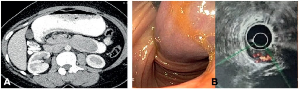 CT image