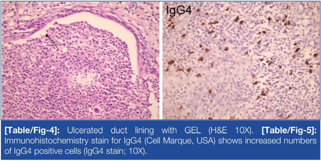stains for IgG4